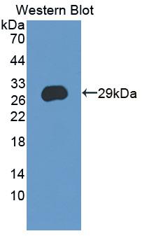 CRISP3 Antibody - Western blot of CRISP3 antibody.