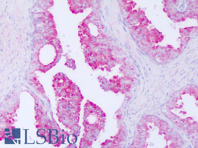 CRISP3 Antibody - Anti-CRISP-3 / SGP28 antibody IHC of human prostate. Immunohistochemistry of formalin-fixed, paraffin-embedded tissue after heat-induced antigen retrieval. Antibody dilution 5-10 ug/ml. This image was taken for the unconjugated form of this product. Other forms have not been tested.