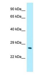 CRISP3 Antibody - CRISP3 / CRISP-3 antibody Western Blot of Fetal kidney.  This image was taken for the unconjugated form of this product. Other forms have not been tested.