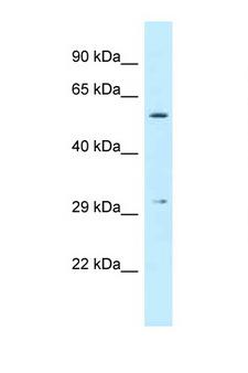 CRISPLD1 Antibody - CRISPLD1 antibody Western blot of Fetal Liver lysate. Antibody concentration 1 ug/ml.  This image was taken for the unconjugated form of this product. Other forms have not been tested.