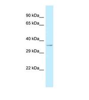 CRISPLD1 Antibody - Western blot of Human 721_B. CRISPLD1 antibody dilution 1.0 ug/ml.  This image was taken for the unconjugated form of this product. Other forms have not been tested.