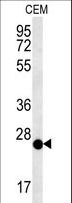CRISPLD2 Antibody - CRISPLD2 Antibody western blot of CEM cell line lysates (15 ug/lane). The CRISPLD2 antibody detected the CRISPLD2 protein (arrow).