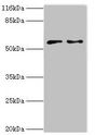 CRISPLD2 Antibody - Western blot All lanes: CRISPLD2 antibody at 2µg/ml Lane 1: Jurkat whole cell lysate Lane 2: CEM whole cell lysate Secondary Goat polyclonal to rabbit IgG at 1/10000 dilution Predicted band size: 56, 52, 43, 18, 14 kDa Observed band size: 56 kDa