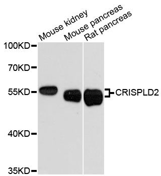 CRISPLD2 Antibody - Western blot analysis of extracts of various cell lines, using CRISPLD2 antibody at 1:3000 dilution. The secondary antibody used was an HRP Goat Anti-Rabbit IgG (H+L) at 1:10000 dilution. Lysates were loaded 25ug per lane and 3% nonfat dry milk in TBST was used for blocking. An ECL Kit was used for detection and the exposure time was 90s.