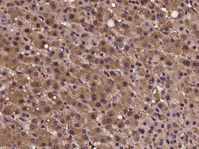CRISPLD2 Antibody - Immunochemical staining of human CRISPLD2 in human liver with rabbit polyclonal antibody at 1:100 dilution, formalin-fixed paraffin embedded sections.