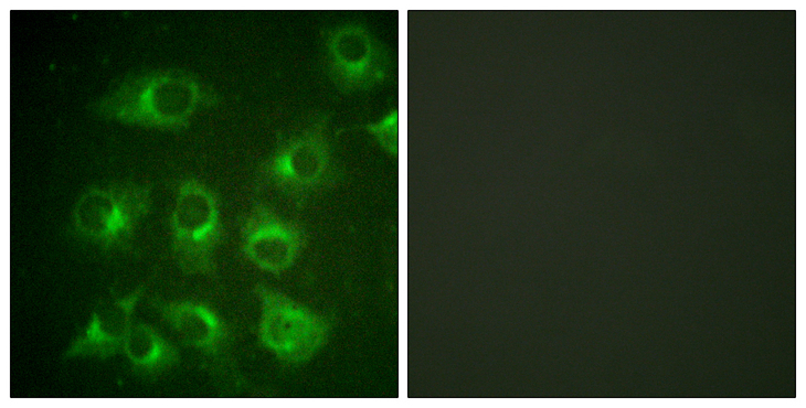 CRK Antibody - Immunofluorescence analysis of HUVEC cells, using CrkII Antibody. The picture on the right is blocked with the synthesized peptide.