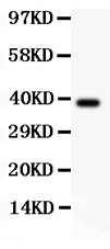 CRK Antibody - Crk p38 antibody Western blot. All lanes: Anti Crk p38 at 0.5 ug/ml. WB: Recombinant Human CRKp38 Protein 0.5ng. Predicted band size: 38 kD. Observed band size: 38 kD.