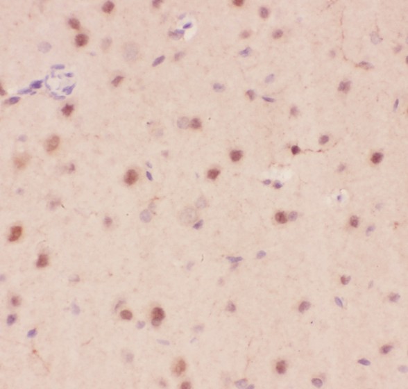 CRK Antibody - Crk p38 antibody IHC-paraffin: Rat Brain Tissue.