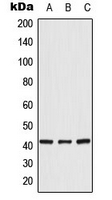 CRK Antibody - Western blot analysis of CRK expression in HeLa (A); K562 (B); NIH3T3 (C) whole cell lysates.