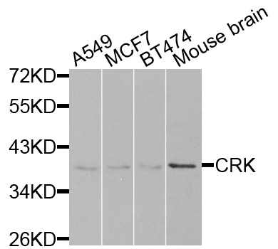CRK Antibody - Western blot analysis of extracts of various cell lines, using CRK antibody at 1:1000 dilution. The secondary antibody used was an HRP Goat Anti-Rabbit IgG (H+L) at 1:10000 dilution. Lysates were loaded 25ug per lane and 3% nonfat dry milk in TBST was used for blocking.