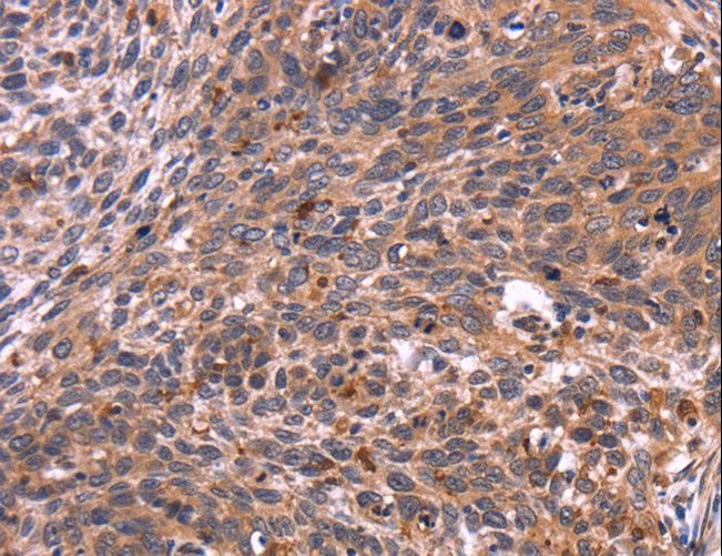CRK Antibody - Immunohistochemistry of paraffin-embedded Human tonsil using CRK Polyclonal Antibody at dilution of 1:40.