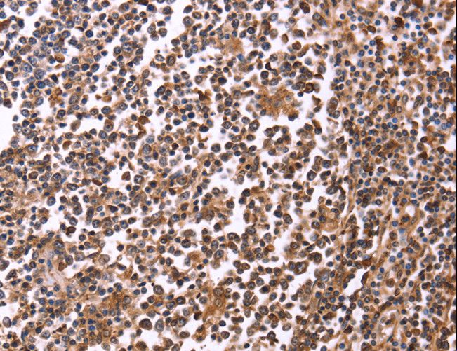 CRK Antibody - Immunohistochemistry of paraffin-embedded Human tonsil using CRK Polyclonal Antibody at dilution of 1:40.