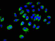 CRK Antibody - Immunofluorescent analysis of A549 cells at a dilution of 1:100 and Alexa Fluor 488-congugated AffiniPure Goat Anti-Rabbit IgG(H+L)