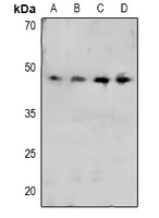 CRK Antibody - Western blot analysis of CRK (pY221) expression in Hela (A), THP1 (B), mouse liver (C), rat liver (D) whole cell lysates.