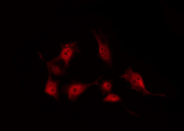 CRK Antibody - Staining COS7 cells by IF/ICC. The samples were fixed with PFA and permeabilized in 0.1% Triton X-100, then blocked in 10% serum for 45 min at 25°C. The primary antibody was diluted at 1:200 and incubated with the sample for 1 hour at 37°C. An Alexa Fluor 594 conjugated goat anti-rabbit IgG (H+L) Ab, diluted at 1/600, was used as the secondary antibody.