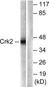 CRK Antibody - Western blot analysis of extracts from COS7 cells, using CrkII (Ab-221) antibody.