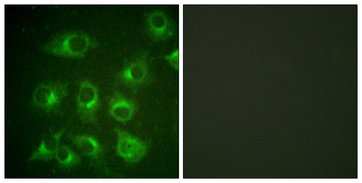CRK Antibody - Peptide - + Immunofluorescence analysis of HuvEc cells, using CrkII (Ab-221) antibody.