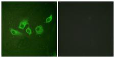 CRK Antibody - Immunofluorescence analysis of HUVEC cells, using CrkII (Phospho-Tyr221) Antibody. The picture on the right is blocked with the phospho peptide.