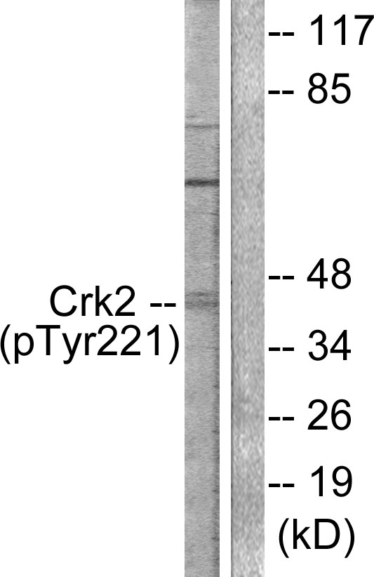 CRK Antibody - Western blot analysis of lysates from COS7 cells, using CrkII (Phospho-Tyr221) Antibody. The lane on the right is blocked with the phospho peptide.