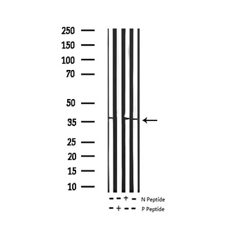 CRK Antibody - Western blot analysis of Phospho-CrkII (Tyr221) expression in various lysates