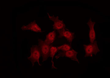 CRK Antibody - Staining COS7 cells by IF/ICC. The samples were fixed with PFA and permeabilized in 0.1% Triton X-100, then blocked in 10% serum for 45 min at 25°C. The primary antibody was diluted at 1:200 and incubated with the sample for 1 hour at 37°C. An Alexa Fluor 594 conjugated goat anti-rabbit IgG (H+L) Ab, diluted at 1/600, was used as the secondary antibody.