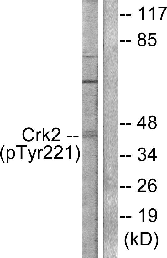 CRK Antibody - Western blot analysis of extracts from cos7 cells, using CrkII (phospho-Tyr221) antibody.