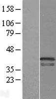 CRK Protein - Western validation with an anti-DDK antibody * L: Control HEK293 lysate R: Over-expression lysate