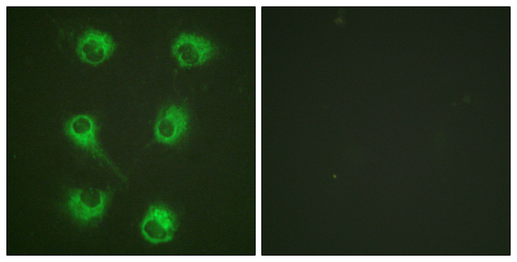 CRKL Antibody - Immunofluorescence analysis of HUVEC cells, using CrkL Antibody. The picture on the right is blocked with the synthesized peptide.