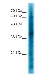 CRKL Antibody - CRKL antibody Western Blot of K562.  This image was taken for the unconjugated form of this product. Other forms have not been tested.