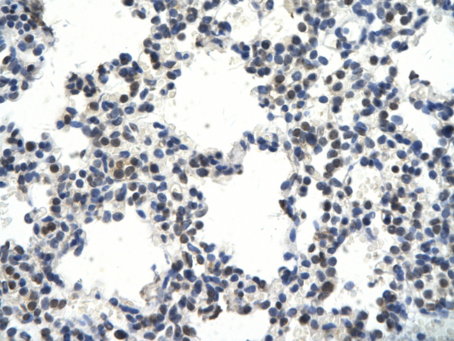 CRKL Antibody - CRKL antibody Immunohistochemistry of Human Lung cell. Cellular Data: Epithelial cells of renal tubule. Antibody Concentration: 4.  This image was taken for the unconjugated form of this product. Other forms have not been tested.