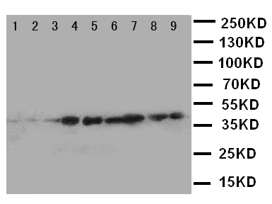 CRKL Antibody - WB of CRKL antibody. Lane 1: Rat Spleen Tissue Lysate. Lane 2: Rat Ovary Tissue Lysate. Lane 3: Rat Testiis Tissue Lysate. Lane 4: M231 Cell lysate. Lane 5: A431 Cell Lysate. Lane 6: MCF-7 Cell Lysate. Lane 7: MM231 Cell Lysate. Lane 8: MM543 Cell Lysate. Lane 9: JURKAT Cell Lysate..
