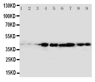 CRKL Antibody - Anti-CrkL antibody, Western blotting All lanes: Anti CrkL at 0.5ug/ml Lane 1: Rat Spleen Tissue Lysate at 50ug Lane 2: Rat Ovary Tissue Lysate at 50ug Lane 3: Rat Testis Tissue Lysate at 50ug Lane 4: MM231 Whole Cell Lysate at 40ug Lane 5: A431 Whole Cell Lysate at 40ug Lane 6: MCF-7 Whole Cell Lysate at 40ug Lane 7: MM231 Whole Cell Lysate at 40ug Lane 8: MM543 Whole Cell Lysate at 40ug Lane 9: JURKAT Whole Cell Lysate at 40ug Predicted bind size: 42KD Observed bind size: 42KD