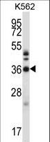 CRKL Antibody - CRKL Antibody western blot of K562 cell line lysates (35 ug/lane). The CRKL antibody detected the CRKL protein (arrow).