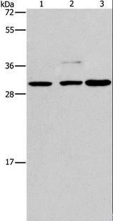 CRKL Antibody - Western blot analysis of Lovo, Raji and A172 cell, using CRKL Polyclonal Antibody at dilution of 1:600.