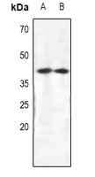 CRKL Antibody - Western blot analysis of CRKL expression in HEK293T (A), SGC7901 (B) whole cell lysates.