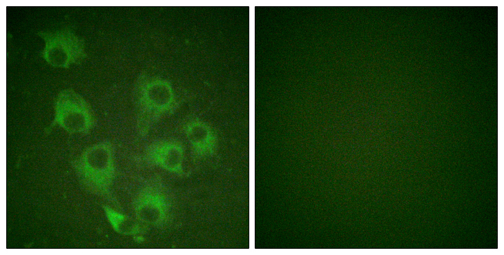 CRKL Antibody - Immunofluorescence analysis of HUVEC cells, using CrkL (Phospho-Tyr207) Antibody. The picture on the right is blocked with the phospho peptide.