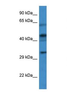 CRLF1 Antibody - CRLF1 antibody Western blot of Jurkat Cell lysate. Antibody concentration 1 ug/ml.  This image was taken for the unconjugated form of this product. Other forms have not been tested.