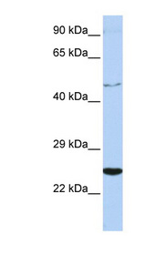 CRLF1 Antibody - CRLF1 antibody Western blot of Jurkat lysate. This image was taken for the unconjugated form of this product. Other forms have not been tested.