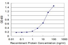 CRLF1 Antibody - Detection limit for recombinant GST tagged CRLF1 is approximately 1 ng/ml as a capture antibody.