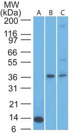 CRLF2 / TSLPR Antibody - Western Blot: TSLP R/CRLF2 Antibody (59N5G4) - Analysis of CRLF2 in an A) partial recombinant protein (0.1 ug/ml), B) human muscle and C) liver lysate (5 ug/ml) using CRLF2 antibody.  This image was taken for the unconjugated form of this product. Other forms have not been tested.