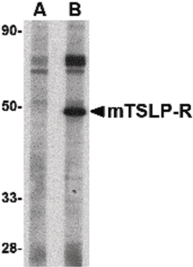 CRLF2 / TSLPR Antibody - Western blot of TSLP Receptor in mouse heart tissue lysate with TSLP Receptor antibody at 1 ug/ml in (A) the presence and (B) the absence of blocking peptide.