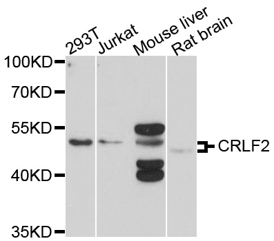 CRLF2 / TSLPR Antibody - Western blot analysis of extracts of various cell lines, using CRLF2 antibody at 1:1000 dilution. The secondary antibody used was an HRP Goat Anti-Rabbit IgG (H+L) at 1:10000 dilution. Lysates were loaded 25ug per lane and 3% nonfat dry milk in TBST was used for blocking. An ECL Kit was used for detection and the exposure time was 90s.