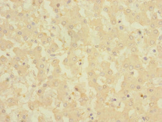 CRLF2 / TSLPR Antibody - Immunohistochemistry of paraffin-embedded human liver tissue at dilution 1:100