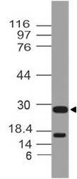 CRLF2 / TSLPR Antibody - Fig-1: Western blot analysis of TSLPR. Anti-TSLPR antibody was used at 2 µg/ml on human heart lysate.