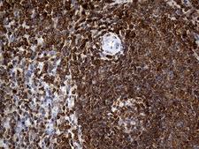CRLF3 Antibody - Immunohistochemical staining of paraffin-embedded Human spleen tissue within the normal limits using anti-CRLF3 mouse monoclonal antibody. (Heat-induced epitope retrieval by 1mM EDTA in 10mM Tris buffer. (pH8.5) at 120°C for 3 min. (1:2000)