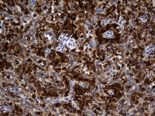 CRLF3 Antibody - Immunohistochemical staining of paraffin-embedded Human spleen tissue within the normal limits using anti-CRLF3 mouse monoclonal antibody. (Heat-induced epitope retrieval by 1mM EDTA in 10mM Tris buffer. (pH8.5) at 120°C for 3 min. (1:500)