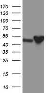 CRLF3 Antibody - HEK293T cells were transfected with the pCMV6-ENTRY control. (Left lane) or pCMV6-ENTRY CRLF3. (Right lane) cDNA for 48 hrs and lysed