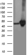 CRLF3 Antibody - HEK293T cells were transfected with the pCMV6-ENTRY control. (Left lane) or pCMV6-ENTRY CRLF3. (Right lane) cDNA for 48 hrs and lysed