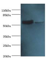 CRMP1 Antibody - Western blot. All lanes: Dihydropyrimidinase-related protein 1 antibody at 2 ug/ml Lane 1:rat brain tissue. Lane 2: mouse lung tissue. Secondary antibody: Goat polyclonal to rabbit at 1:10000 dilution. Predicted band size: 62 kDa. Observed band size: 62 kDa.  This image was taken for the unconjugated form of this product. Other forms have not been tested.
