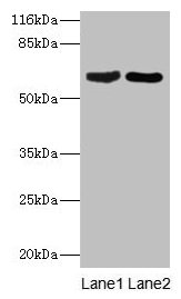 CRMP1 Antibody - Western blot All lanes: Dihydropyrimidinase-related protein 1 antibody at 2µg/ml Lane 1: Rat brain tissue Lane 2: Mouse lung tissue Secondary Goat polyclonal to rabbit IgG at 1/10000 dilution Predicted band size: 63, 75 kDa Observed band size: 63 kDa